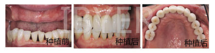 ֲڶǮ