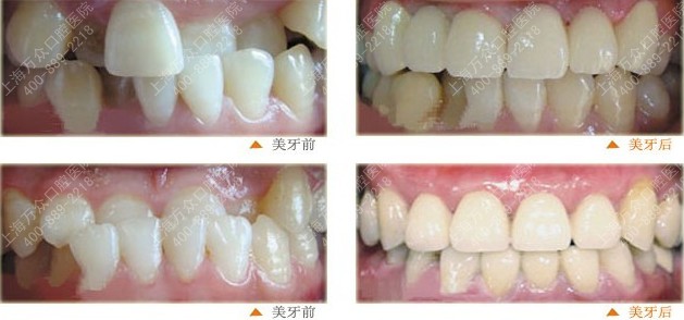Ϻݺ 